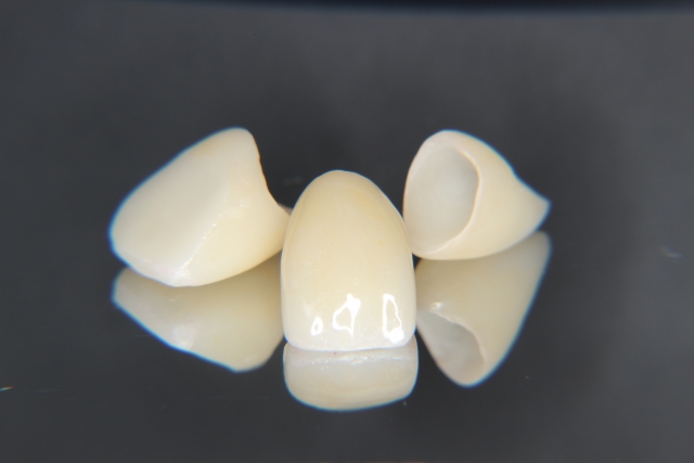 セラミック矯正