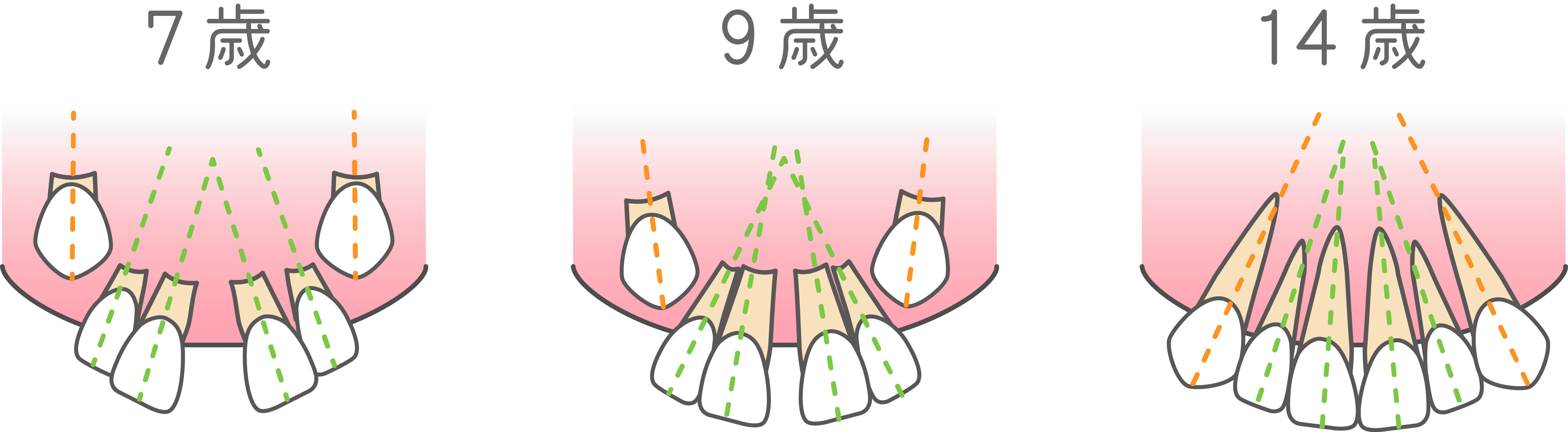 「みにくいアヒルの子」の時期