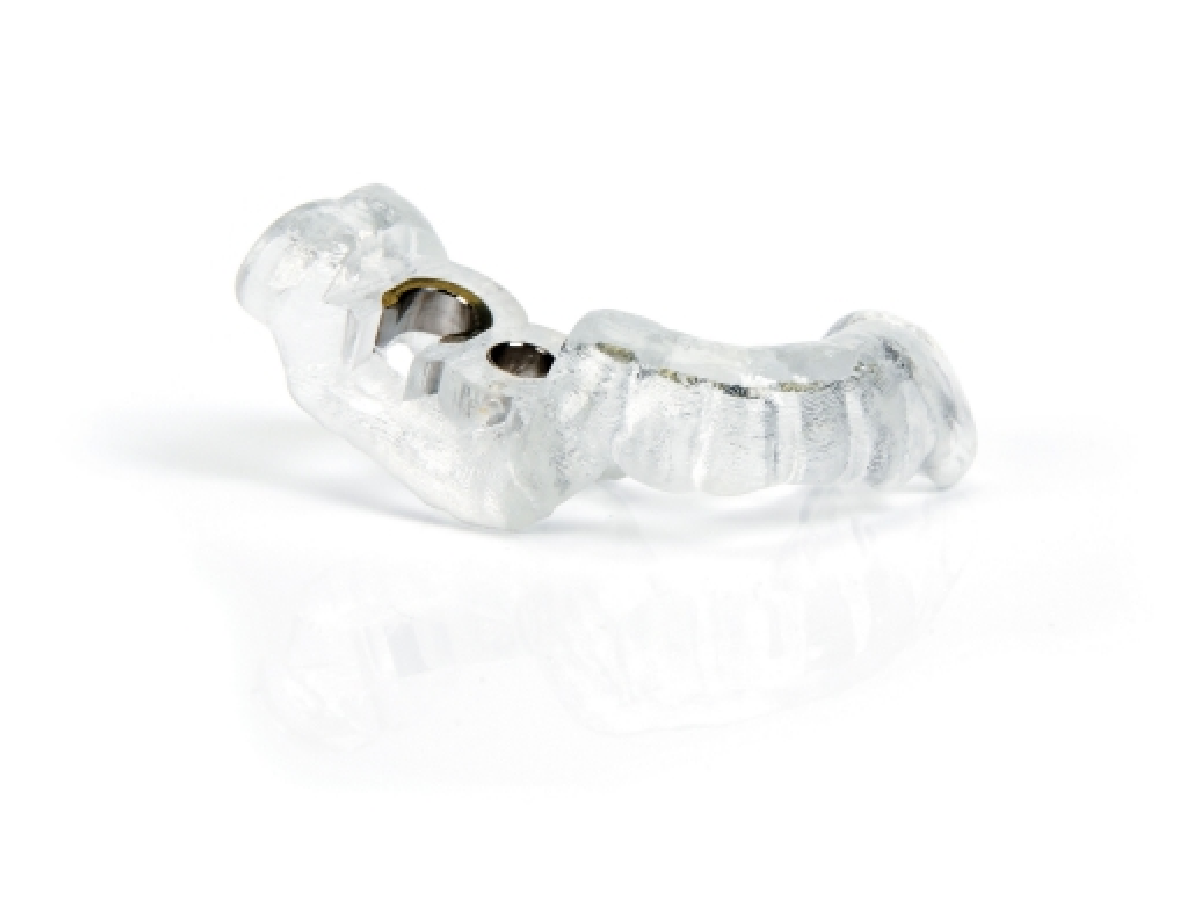 インプラント サージカルガイド写真