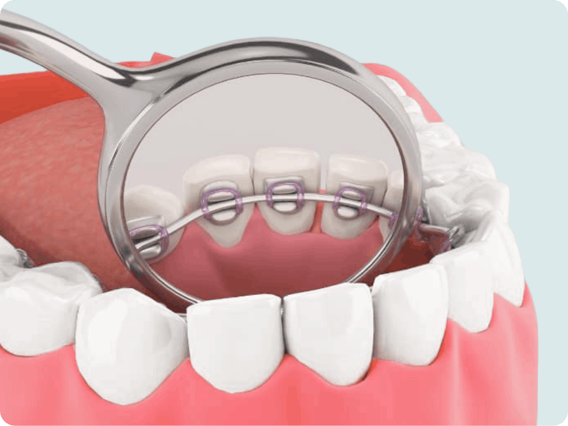 矯正歯科 イメージ