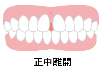 正中離開（せいちゅうりかい）
